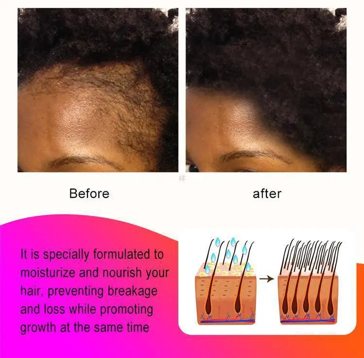 Fast Hair Growth Oil — Root Repair Treatment