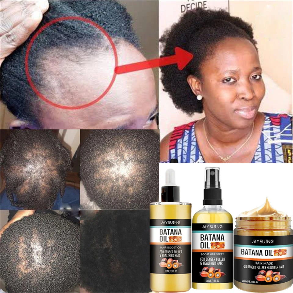 Fast Hair Growth Oil — Root Repair Treatment